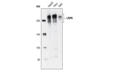 Western blot analysis of total cell lysates from HepG2, HeLa and Rat2 cells using LRP6 (C5C7) Rabbit mAb.