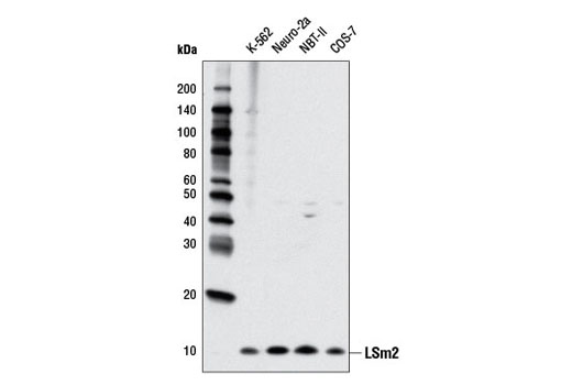 Western blot analysis of extracts from various cell lines using LSm2 (D9X6C) Rabbit mAb.