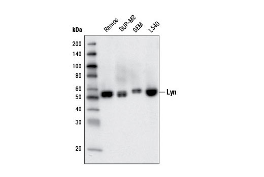 Western blot analysis of extracts from various cell lines using Lyn (5G2) Mouse mAb.