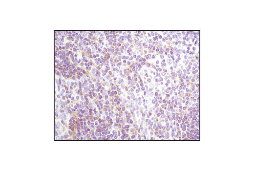 Immunohistochemical analysis of paraffin-embedded non-hodgkins lymphoma using Lyn (C13F9) Rabbit mAb.