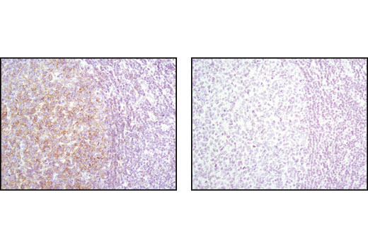 Immunohistochemical analysis of paraffin-embedded human tonsil tissue using Lyn (C13F9) Rabbit mAb in the presence of control peptide (left) and antigen specific peptide (right).