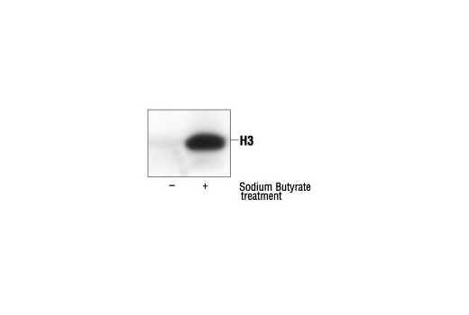Western blot analysis of extracts from NIH/3T3 cells, untreated or sodium butyrate-treated (5 mM for 24 hours), showing an increase in histone acetylation using Acetylated-Lysine Antibody.