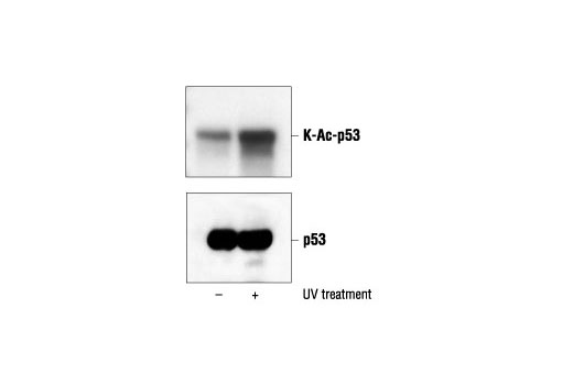 Western blot analysis of immunoprecipitated p53 showing an increase in p53 acetylation using Acetylated-Lysine Antibody (upper) or p53 antibody (lower). p53 was immunoprecipitated from lysates from 293 cells, untreated or UV-treated, using p53 Antibody #9282.