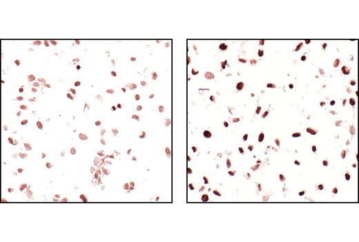 Immunohistochemical analysis of paraffin-embedded NIH/3T3 untreated (left) or TSA-treated (right) using Acetylated-Lysine Antibody.