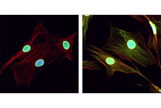 Confocal immunofluorescent analysis of NIH/3T3 cells, untreated (left) or SAHA-treated (right), labeled with Acetylated-Lysine Antibody (green). Actin filaments have been labeled with Alexa Fluor R 555 phalloidin (red). Blue pseudocolor = DRAQ5 ® #4084 (fluorescent DNA dye).