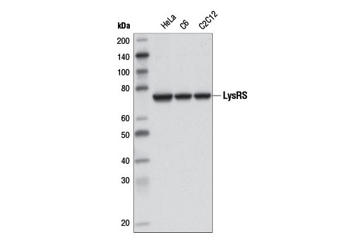 Western blot analysis of extracts from various cell lines using LysRS (D16D1) Rabbit mAb.