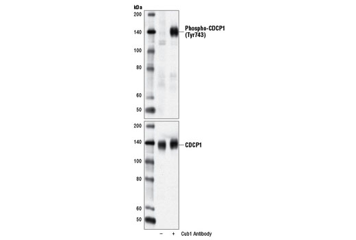 Western blot analysis of extracts from ZR-75-1 cells, untreated (-) or treated with a Cub1 antibody (+), using Phospho-CDCP1 (Tyr743) Antibody (upper) and CDCP1 Antibody #4115 (lower).