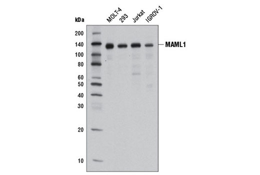 Western blot analysis of extracts from various cell lines using MAML1 (D3K7B) Rabbit mAb.