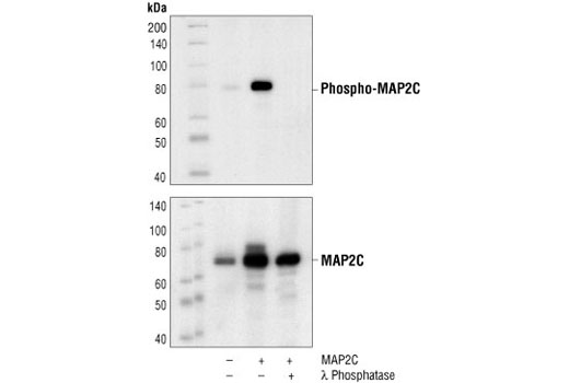 Western blot analysis of extracts from COS cells, untransfected (lane 1), or MAP2C transfected (lanes 2,3), using Phospho-MAP2 (Thr1620/1623) Antibody (upper) or MAP2 Antibody #4542 (lower). In lane 3, the lysate was treated with lamda phosphatase to demonstrate phospho-specificity of the antibody. (Human MAP2C construct is a generous gift from Dr. B. Shafit-Zagardo, Dept. of Pathology, Albert Einstein College of Medicine, Bronx, NY.)