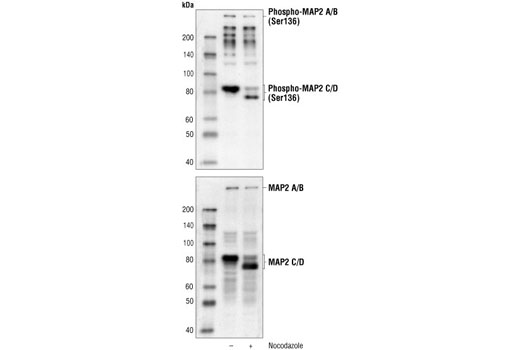 Western blot analysis of extracts from PC12 cells, untreated or nocodazole-treated, using Phospho-MAP2 (Ser136) Antibody (upper) or MAP2 Antibody #4542 (lower).