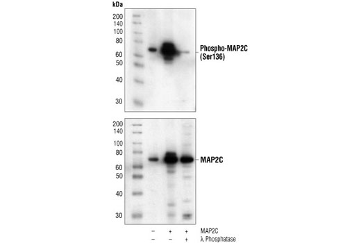 Western blot analysis of extracts from COS cells, untransfected (lane 1) or MAP2C-transfected (lanes 2,3), using Phospho-MAP2 (Ser136) Antibody (upper) or MAP2 Antibody #4542 (lower). In lane 3, the lysate was treated with lamda phosphatase to demonstrate phospho-specificity of the antibody. (Human MAP2C construct is a generous gift from Dr. B. Shafit-Zagardo, Dept. of Pathology, Albert Einstein College of Medicine, Bronx, NY.)