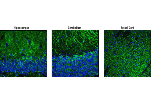 Confocal immunofluorescent analysis of rat cerebellum, hippocampus and spinal cord (as indicated) using MAP2 Antibody (green). Blue pseudocolor = DRAQ5 ® #4084 (fluorescent DNA dye).