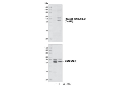 Western blot analysis of extracts from NIH/3T3 cells, untreated (-) or UV- and TPA-treated (+), using Phospho-MAPKAPK-2 (Thr222) (9A7) Rabbit mAb (upper) or MAPKAPK-2 Antibody #3042 (lower).