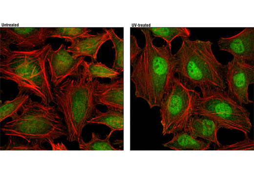 Confocal immunofluorescent analysis of HeLa cells, untreated (left) or treated with UV (100 mJ/cm 2 with 30 min recovery; right), using p38 MAPK (D13E1) XP ® Rabbit mAb (green). Actin filaments were labeled with DY-554 phalloidin (red).