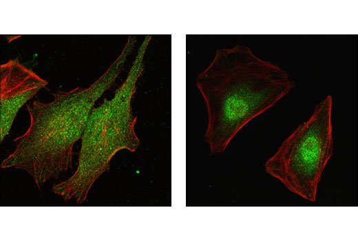 Confocal immunofluorescent analysis of HeLa cells, untreated (left) or anisomycin-treated (right), using p38-alpha MAPK (L53F8) Mouse mAb (green). Actin filaments have been labeled with Alexa Fluor® 555 phalloidin (red).