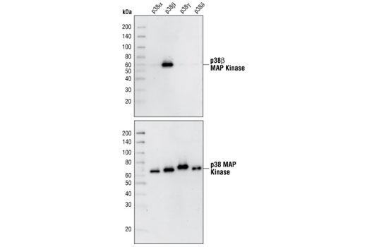 Western blot analysis of purified recombinant full-length p38 MAPK GST-fusion proteins, using p38β MAPK (C28C2) Rabbit mAb (upper), or a p38 MAPK pan antibody (lower).