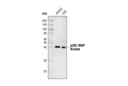 Westen blot analysis of extracts from HUVEC and COS cells using p38β MAPK (C28C2) Rabbit mAb.