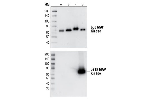 Western blot analysis of purified recombinant full-length p38 MAPK GST fusion proteins, using p38 MAPK pan antibody (upper), or p38δ MAPK (10A8) Rabbit mAb (lower).