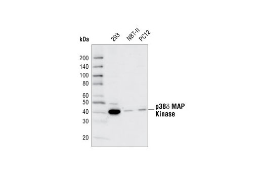 Western blot analysis of extracts from 293, NBT-II and PC12 cells, using p38δ MAPK (10A8) Rabbit mAb.