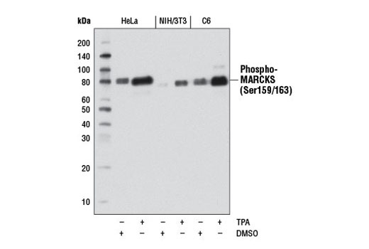 Western blot analysis of extracts from HeLa, NIH/3T3, and C6 cells, serum starved overnight and either DMSO-treated or treated with TPA #4174 (200 nM, 15 min), using Phospho-MARCKS (Ser159/163) (D13D2) Rabbit mAb.