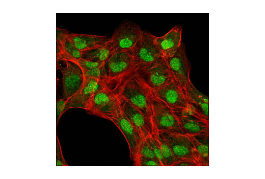 Confocal immunofluorescent analysis of ACHN cells using Max (S20) Antibody (green). Actin filaments have been labeled with DY-554 phalloidin (red).