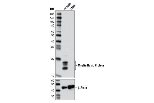 Western blot analysis of extracts from rat brain and KNRK cells using Myelin Basic Protein (2H9) Mouse mAb (upper) or β-Actin (D6A8) Rabbit mAb #8457 (lower).
