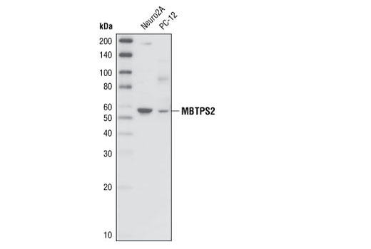 Western blot analysis of extracts from Neuro2A and PC-12 cells, using MBTPS2 Antibody.