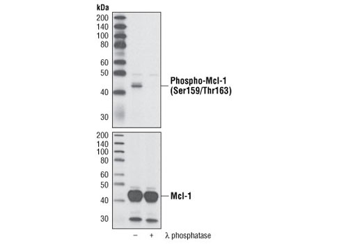 Western blot analysis of extracts from HeLa cells transfected with human Mcl-1, untreated or treated with λ-phosphatase, using Phospho-Mcl-1 (Ser159/Thr163) Antibody (upper) or with total Mcl-1 Antibody #4572 (lower).