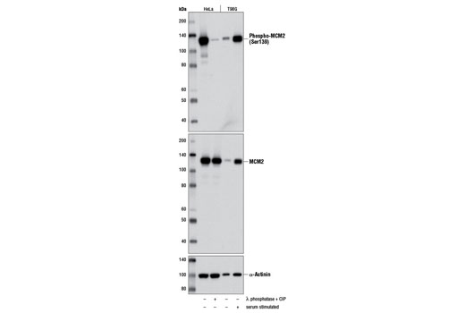 Western blot analysis of HeLa cell extracts, untreated (-) or calf intestinal phosphatase (CIP) and λ phosphatase-treated (+), and extracts of T98G cells serum-starved for 48 hours (-) or serum starved for 48 hours followed by serum-stimulation for 24 hours (+), using Phospho-MCM2 (Ser139) (D1Z8X) XP ® Rabbit mAb (upper), MCM2 (D7G11) XP ® Rabbit mAb #3619 or α-Actinin (D6F6) XP ® Rabbit mAb #6487.
