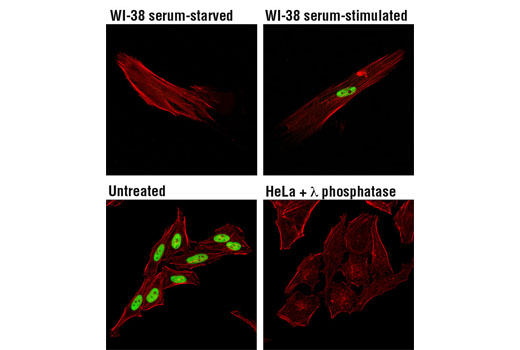 Confocal immunofluorescent analysis of WI-38 cells, serum-deprived (48 hr; upper left), or serum-treated (10%, 24 hr; upper right) and HeLa cells, untreated (lower left), or λ phosphatase-treated (2 hr; lower right), using Phospho-MCM2 (Ser139) (D1Z8X) XP ® Rabbit mAb (green). Actin filaments were labeled with DY-554 phalloidin (red).