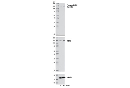 Western blot analysis of extracts from WI-38 cells, synchronized by serum starvation, using Phospho-MCM2 (Ser139) Antibody (upper), MCM2 (D7G11) XP ® Rabbit mAb #3619 (middle), and β-Actin (13E5) Rabbit mAb #4970 (lower). Cells were synchronized for 72 hours and then released by addition of serum and harvested at the times indicated.