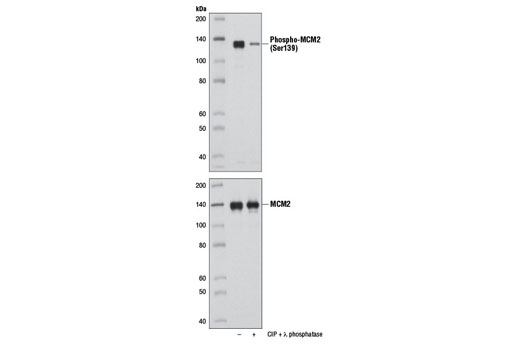 Western blot analysis of extracts from U-2 OS cells, untreated (-) or treated with calf intestinal phosphatase (CIP) and λ phosphatase (+), using Phospho-MCM2 (Ser139) Antibody (upper) and MCM2 (D7G11) XP ® Rabbit mAb #3619 (lower).