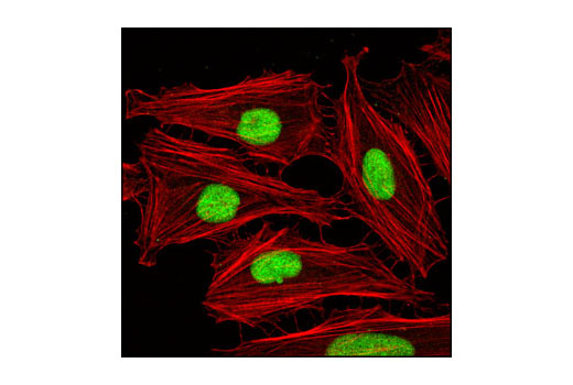 Confocal immunofluorescent analysis of HeLa cells using MCM3 Antibody (green). Actin filaments have been labeled with DY-554 phalloidin (red).