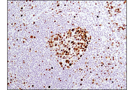 Immunohistochemical analysis of paraffin-embedded human tonsil using MCM4 (D3H6N) XP® Rabbit mAb.