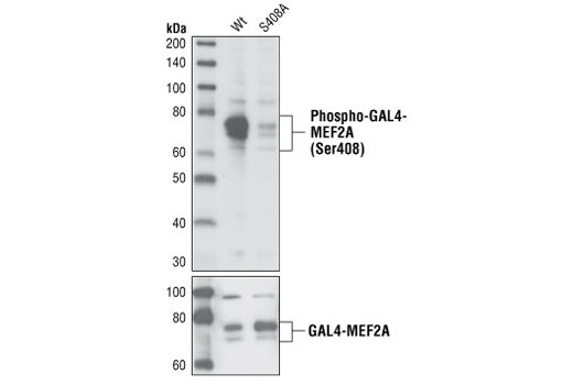 Western blot analysis of extracts from COS-7 cells transfected with wild-type GAL4-MEF2A or mutant GAL4-MEF2A (S408A), using Phospho-MEF2A (Ser408) Antibody (top) and MEF2A Antibody #9736 (bottom).