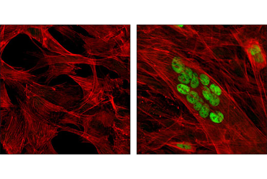 Confocal immunofluorescent analysis of C2C12 cells, undifferentiated (left) or differentiated for 3 days (right), using MEF2C (D80C1) XP ® Rabbit mAb (green). Actin filaments were labeled with DY-554 phalloidin (red).