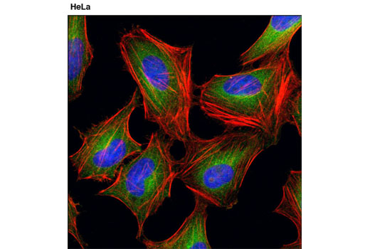 Confocal immunofluorescent analysis of HeLa cells using MEK1/2 (D1A5) Rabbit mAb (green). Actin filaments were labeled with DY-554 phalloidin. Blue pseudocolor = DRAQ5 ® #4084 (fluorescent DNA dye).