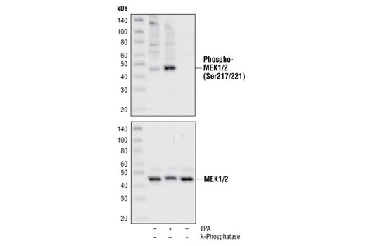Western blot analysis of extracts from untreated, TPA-treated or lambda phosphatase-treated HeLa cells, using Phospho-MEK 1/2 (Ser217/221) Antibody #9121 (upper) or MEK 1/2 Antibody #9122 (lower).