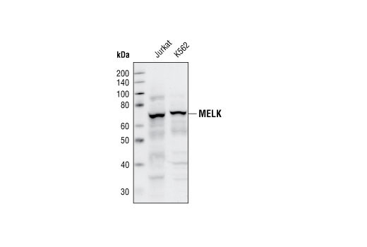 Western blot analysis of extracts of jurkat and K562 cells, using MELK Antibody.