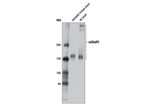 Western blot analysis of extracts from neonatal mouse brain and rat brain using mGluR1 (D5H10) Rabbit mAb.