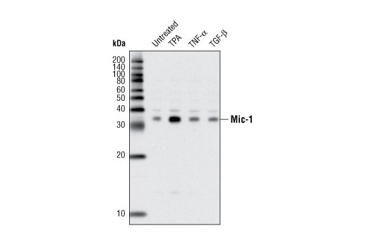 Western blot analysis of extracts from HT-1080 cells, untreated or treated with TPA, TNF-α or TGF-β (6 hrs), using Mic-1 (L300) Antibody.