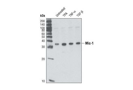 Western blot analysis of extracts from HT-1080 cells, untreated or treated with TPA, TNF-α or TGF-β (6 hrs), using Mic-1 (Y60) Antibody.