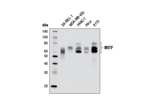 Western blot analysis of extracts from various cell lines using MITF (D5G7V) Rabbit mAb.