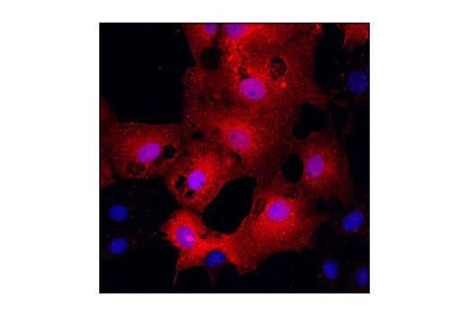  Confocal immunofluorescent analysis of COS cells transiently transfected with a DYKDDDDK-tagged fusion protein using DYKDDDDK Tag Antibody (Binds to same epitope as Sigma's Anti-FLAG® M2 Antibody) (Alexa Fluor® 555 Conjugate) (red). Blue pseudocolor = DRAQ5® #4084 (fluorescent DNA dye).