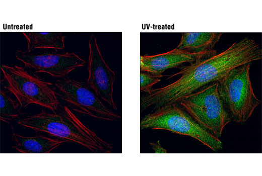 Phospho-MKK3 (Ser189)/MKK6 (Ser207) Antibody #9231. Mouse Anti-rabbit IgG (Conformation Specific) (L27A9) mAb #3678 was used as a secondary antibody.