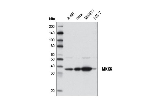 Western blot analysis of extracts from various cell lines using MKK6 (D31D1) Rabbit mAb.