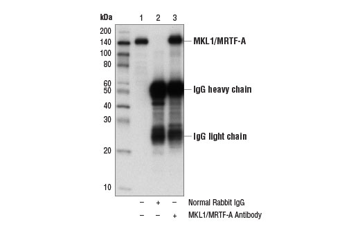 Immunoprecipitation of MKL1/MRTF-A protein from 293 cell extracts using Normal Rabbit IgG #2729 (lane 2) or MKL1/MRTF-A Antibody (lane 3). Lane 1 is 10% input. Western blot analysis was performed using MKL1/MRTF-A Antibody.