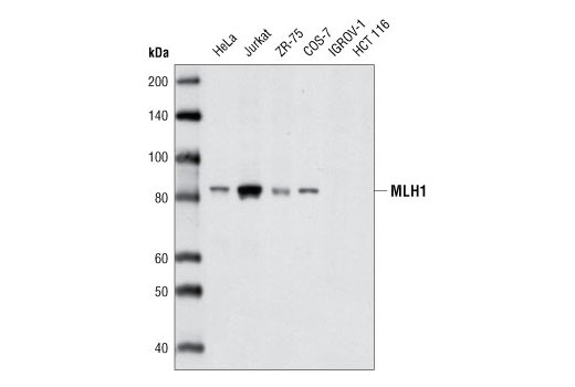 Western blot analysis of extracts from various cell types using MLH1 (D38G9) Rabbit mAb.