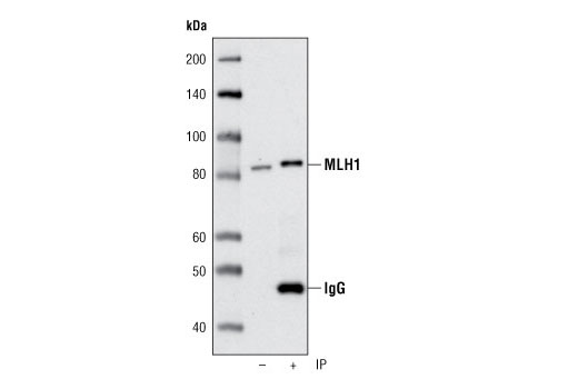 Immunoprecipitation of MLH1 from HeLa cells using MLH1 (D38G9) Rabbit mAb. Western blot was performed using the same antibody. IP () is 5% input.
