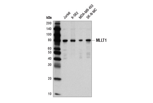 Western blot analysis of extracts from various cell lines using MLLT1/ENL (D9M4B) Rabbit mAb.